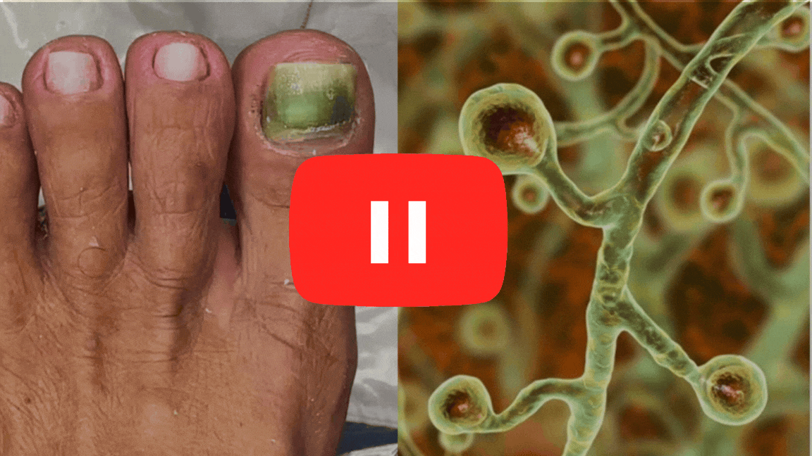 Yellow foot nail and live cell imaging